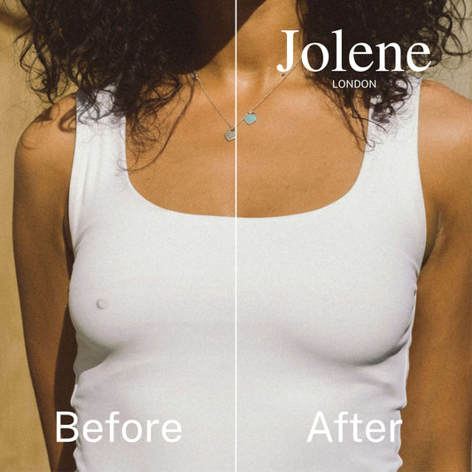 What to Wear Under a Backless or Strapless Dress (No Bra Required)