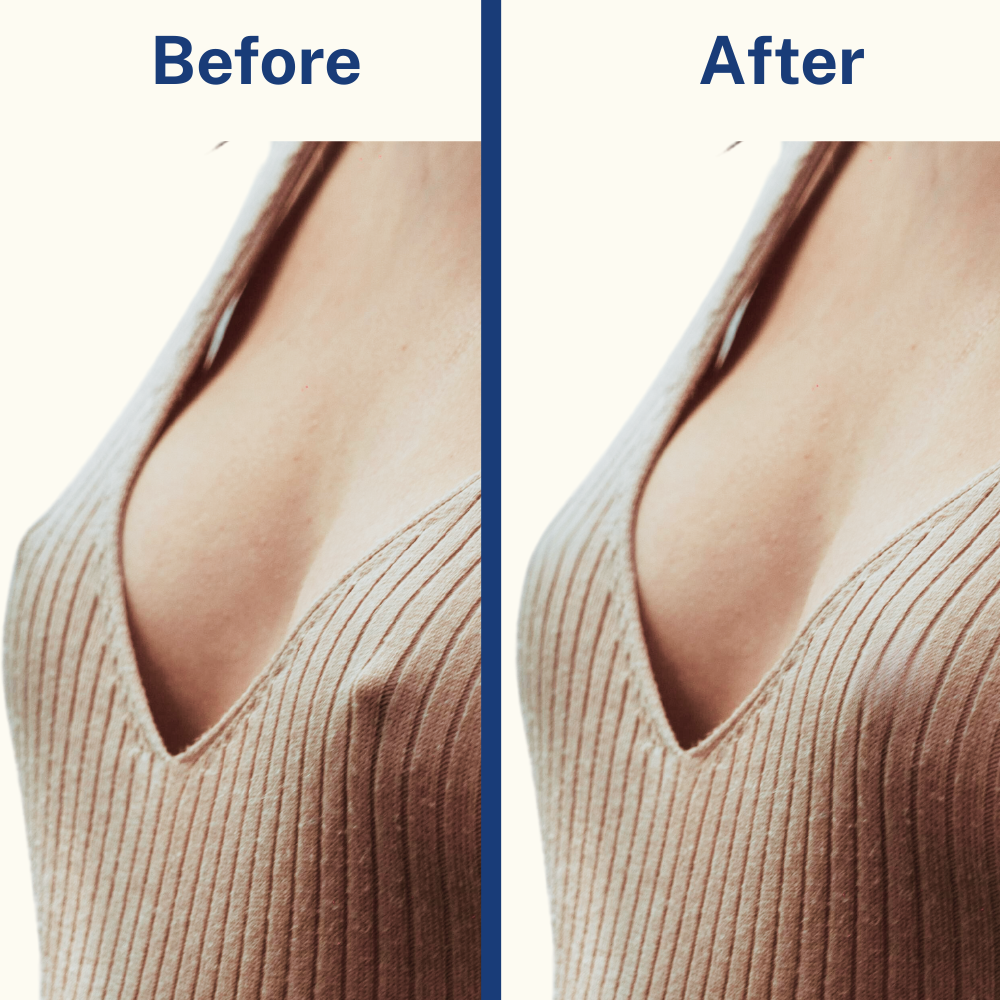 Hiding Nipples After Breastfeeding: Confidence-Boosting Solutions That Work