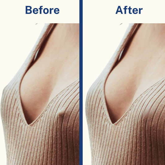 Hiding Nipples After Breastfeeding: Confidence-Boosting Solutions That Work