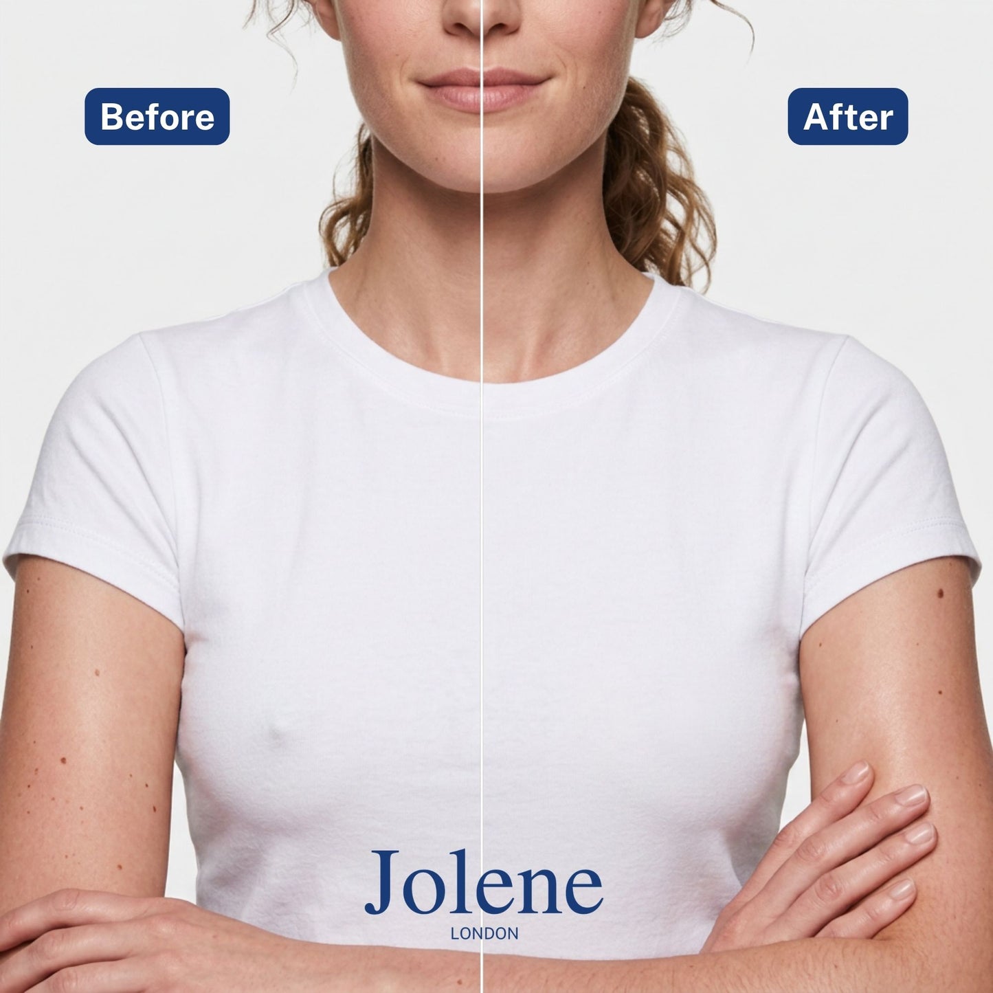 Jolene Best UK Nipple Covers Before & After Image
