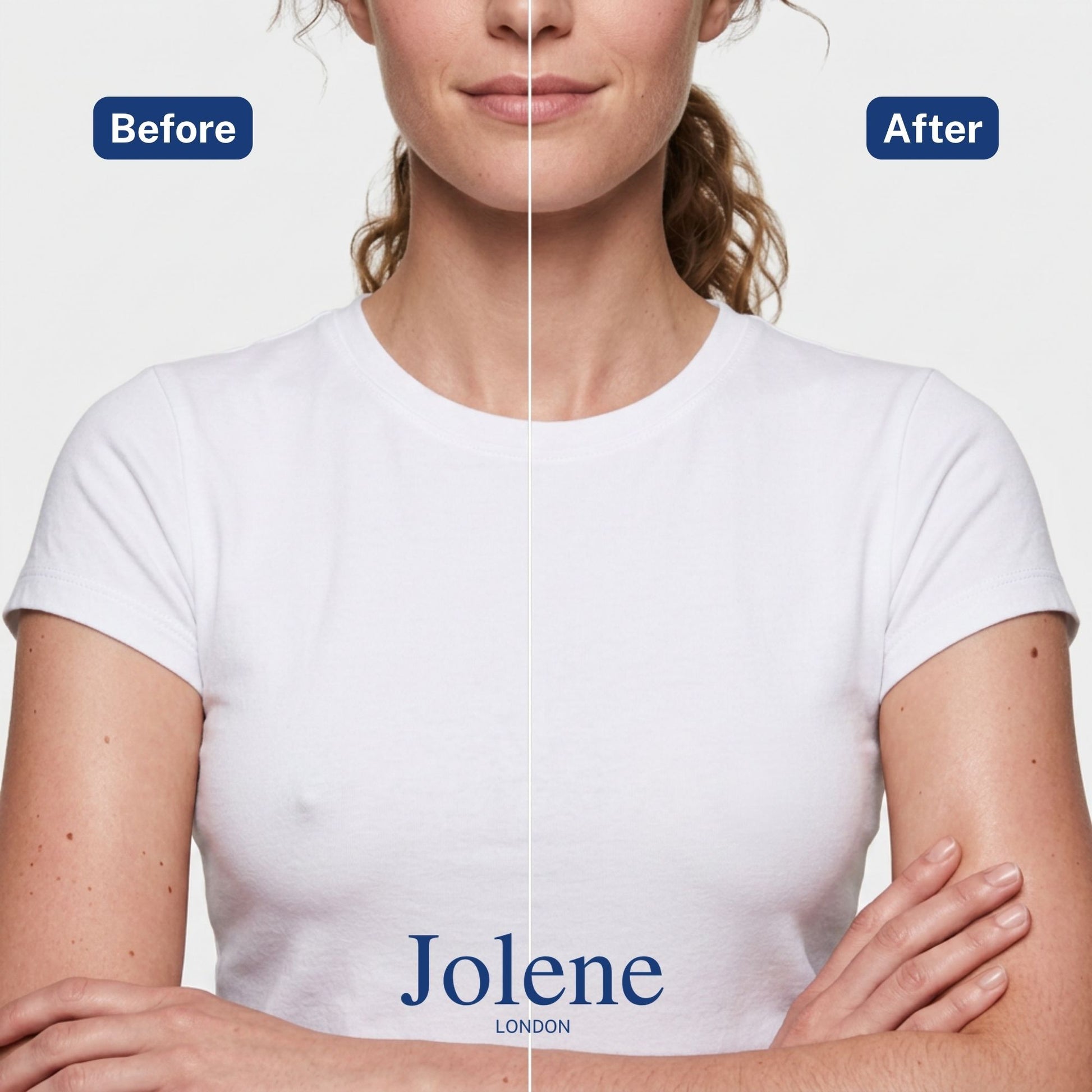 Jolene Best UK Nipple Covers Before & After Image